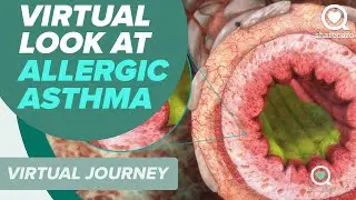 What Is Allergic Asthma? | Virtual Look At Your Body