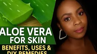 How to Use Aloe Vera For Acne, Dark Spots & Anti-Aging.