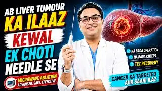 Liver Cancer Ka Ilaj Bina Cheera | Microwave Ablation Explained