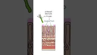 Peptic Ulcers #medicine #medicalstudent #gastroenterology
