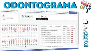 Odontograma - Conhe&ccedil;a um pouco mais - Software Odontol&oacute;gico - Life Dental