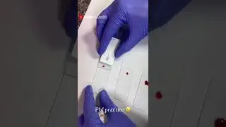 Peripheral blood film #laboratory #medlab #medicaleducation #lifeisbutadream