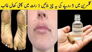Winter Special Anti Aging hand and feet Skin Brightening cream | dry skin & cracked heels remedy