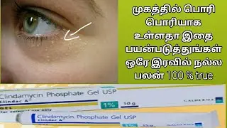Clindamycin phosphate gel usp review tamil/clindac A/Best cream for dry skin/acne removal