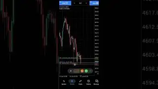 How I Set Stop Loss and Take Profit in Gold Trading #forexshorts #trading #stockmarket #forex