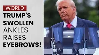 Врач Трампа что-то скрыл? Информация о опухших лодыжках стала вирусной после саммита АСЕАН