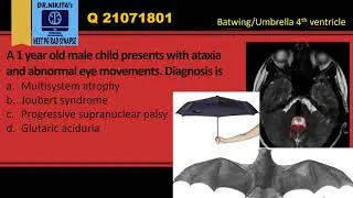 Joubert syndrome- Synopsis