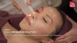 CACI  Non Surgical Face Lift