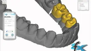 Zfx CAD Software - Bridge