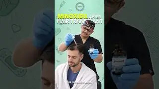 Is Minoxidil really necessary after a hair transplant? 🤔