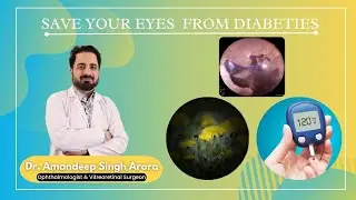 Retinopathy Awareness || Arora eye hospital and retina centre