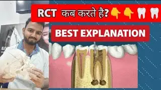 Painless RCT Process | Modern Root Canal Techniques Explained|Rct Kyu karte Hai|