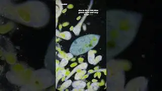 One Of The Largest Single Cell Organisms Under Microscope (Stentor coeruleus)