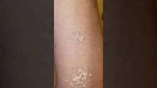 Fake vs Real/ authentic Bare Minerals powder foundation