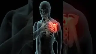 Helmet valla neck pain vasthunda   Idhi Mee Kosame  🛵💪   recureclinic  vizag  chiropracticcare  pa