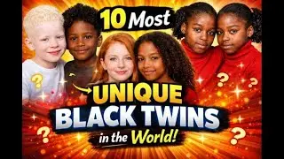 10 Most Unique Black Twins | Rare Genetics, Identity & Powerful Stories