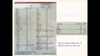 The Lyme and Gut Connection  The Role of Diet  and Gastrointestinal Health in Treating Lyme Disease