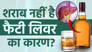 Fatty Liver Symptoms: Alcohol के बिना भी Liver खराब? Non Alcoholic Fatty Liver Disease (MASLD)