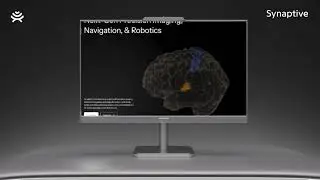 Synaptive Medical x Ankord Media: Designing for Life Saving Innovation