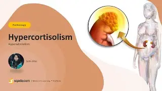 Hyperadrenalism | Hypercortisolism | Medical Student Pathology Education