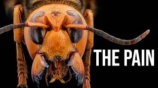 What Exactly Is: Hornet | Stings of Pain