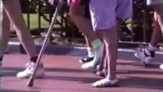Pretty polio woman limping with legbrace and crutches.