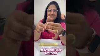 😳#artificialfinger 👉🏻prosthesis. #नकली ऊंगली #newtreatment #fakefinger #removable #silicone