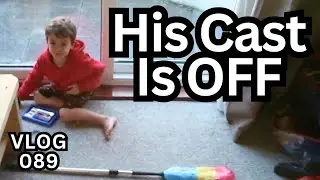 He's Got His Cast Off!|Autism Family Vlog_089