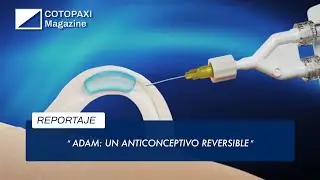 ADAM: a reversible contraceptive