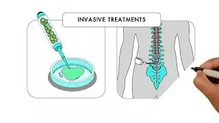 Alternative Treatments for SCI: Benefits, Risks & Reality
