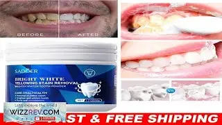 Teeth Whitening Powder Tea Coffee Smoking Stain Remover Tooth Deep Cleaning 50g
