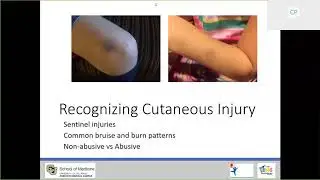 EMSC Webinar: Child Abuse Screening