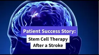 Patient Success Story: Remarkable Recovery with Stem Cell Therapy After Stroke
