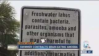 Swimmer contracts brain-eating amoeba in South Florida
