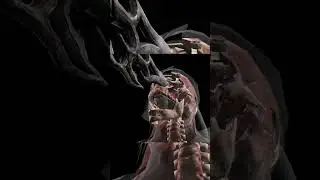 Mk X Mobile Klassic scorpion X-ray Attack #shorts #short