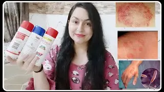 #candid #Dusting Powder#Skin Allergies #Fungal #Infections #Sensitivity#Skin  Care Series