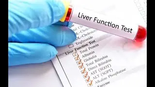 Liver Functional Test