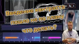 Введение контраста на КТ пошло не по плану. Что делать? CT Siemens Go.