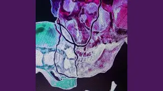 LATENIGHTPHONK