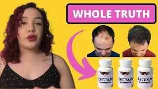 Restolin Hair Loss | Restolin Hair Before And After | Restolin Hair Growth Reviews | Restolin Hair