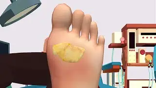 Foot Clinic - ASMR Feet Care &copy; All Levels Gameplay Walkthrough (Android, IOS)