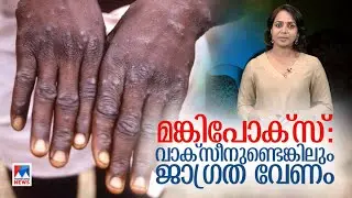 മങ്കിപോക്സ്: വാക്സീനുണ്ട്, കുട്ടികളും സൂക്ഷിക്കണം | Monkeypox | Vaccine