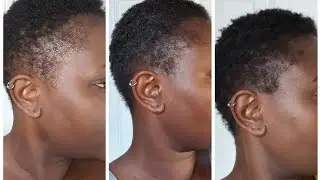 1 MONTH UPDATE: SULPHUR 8, DOO GRO.. 4C HAIR GROWTH