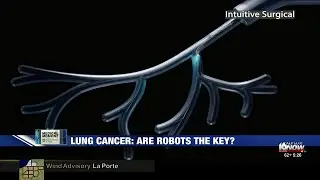 Medical Moment: Using robots to detect lung cancer early