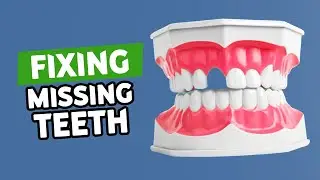 Restoring Missing Teeth: Bone Grafting for Dental Implants