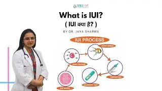 What is IUI ? | Infertility | fertility  | Dr. Jaya Sharma | Noble IVF | Aligarh