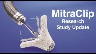 MitraClip Update:  The COAPT Trial Results Are Encouraging!