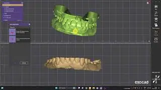 How To align Bite in Exocad? #exocad #digitaldentistry #dentist #dentalprosthesis