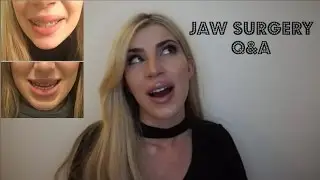 JAW SURGERY CHANGED MY LIFE (PART 2): Q&A