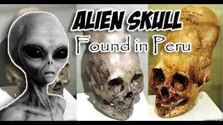 Alien Skull Found in Peru (over 300 of these alien skulls found in a massive grave)